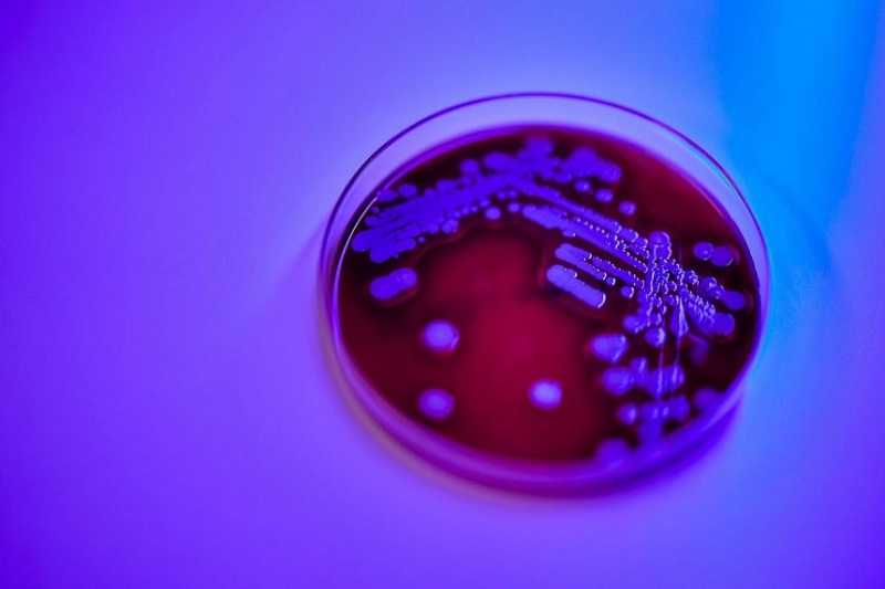 Ilmuwan Temuan Spesies Bakteri Baru yang Dinamai Singapura