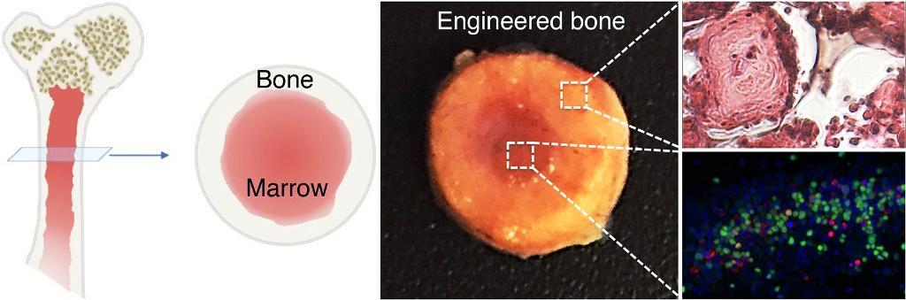 Tulang Biomimetik untuk Transplantasi Sumsum Tulang Baru