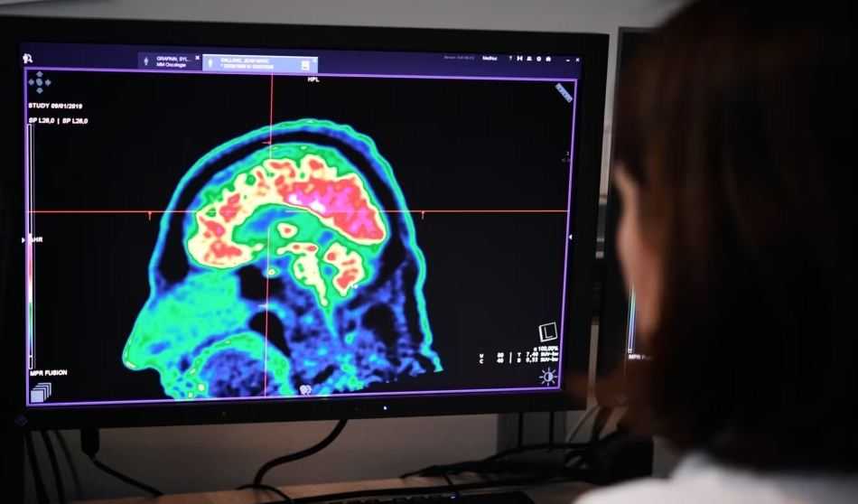 Terobosan Baru, Ilmuwan Gunakan Pemindai Otak dan AI untuk 'Membaca' Pikiran