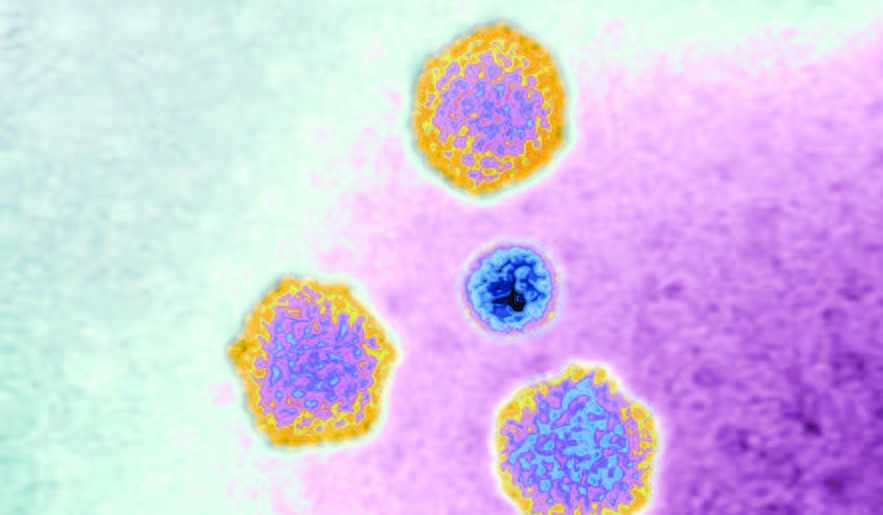 Virus Penyebab Wabah Hepatitis Akut Masih Terus Diselidiki