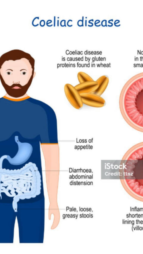 Hati-hati Konsumsi Gandum Berlebih, Penyakit Autoimun Celiac Mulai Merebak di Asia 