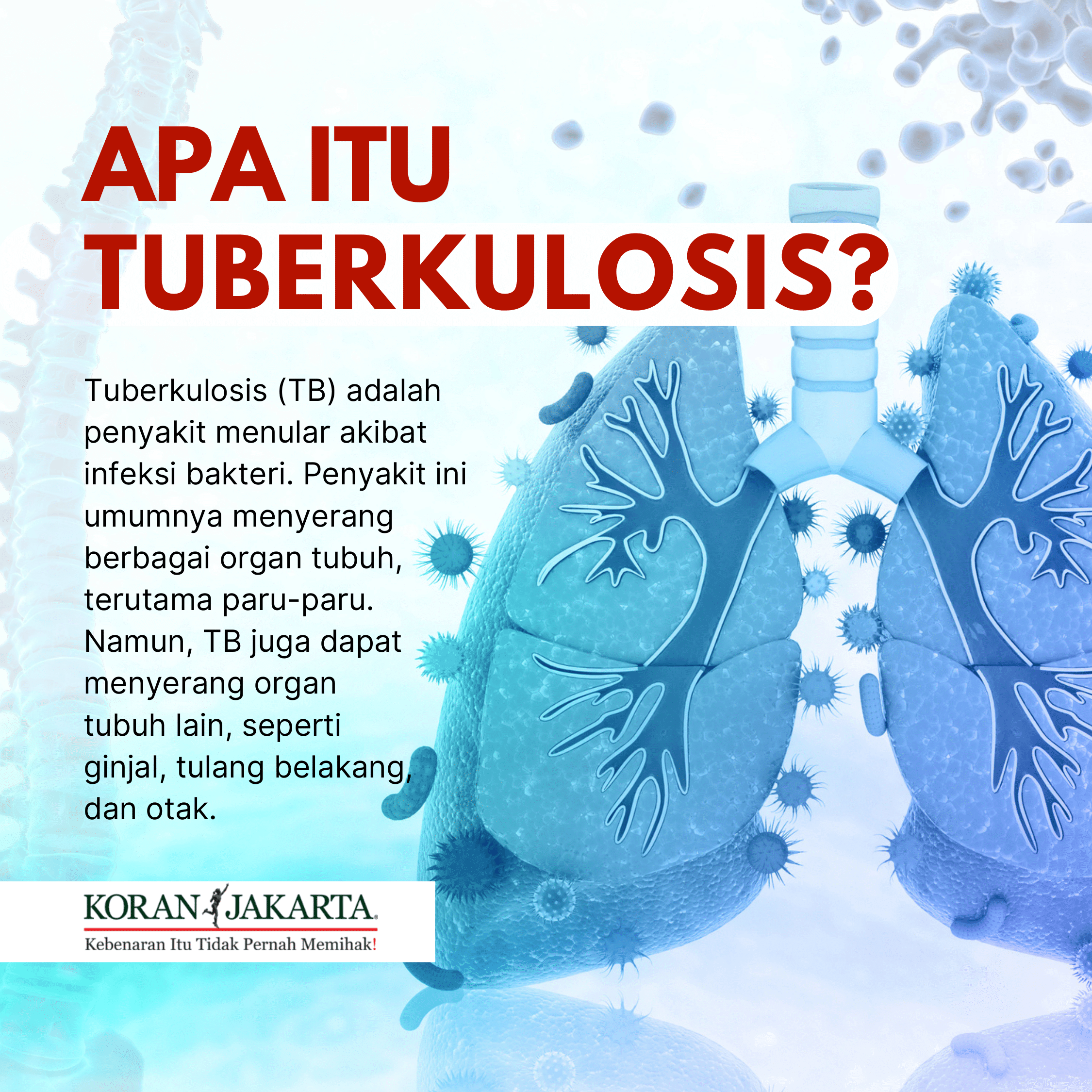 Indonesia Nomor Dua Kasus Tuberkulosis di Dunia 2