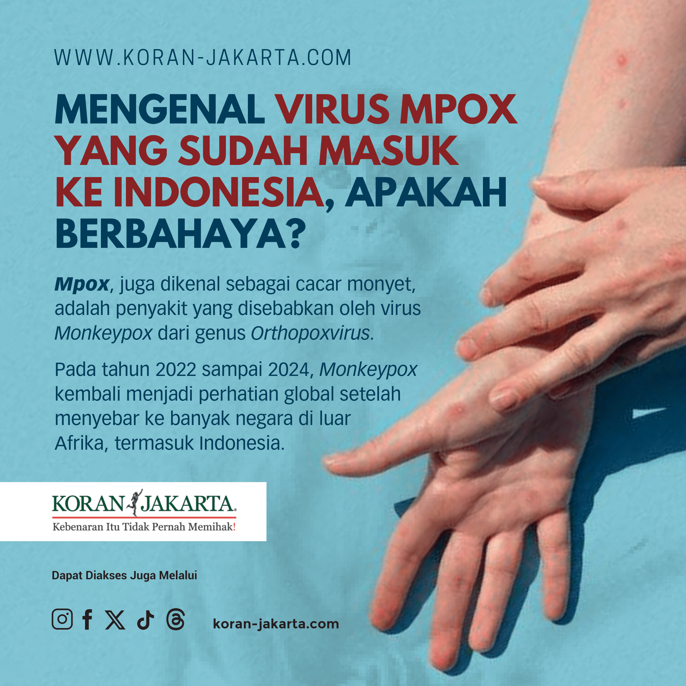 Mengenal Virus Mpox yang Sudah Masuk ke Indonesia, Apakah Berbahaya?