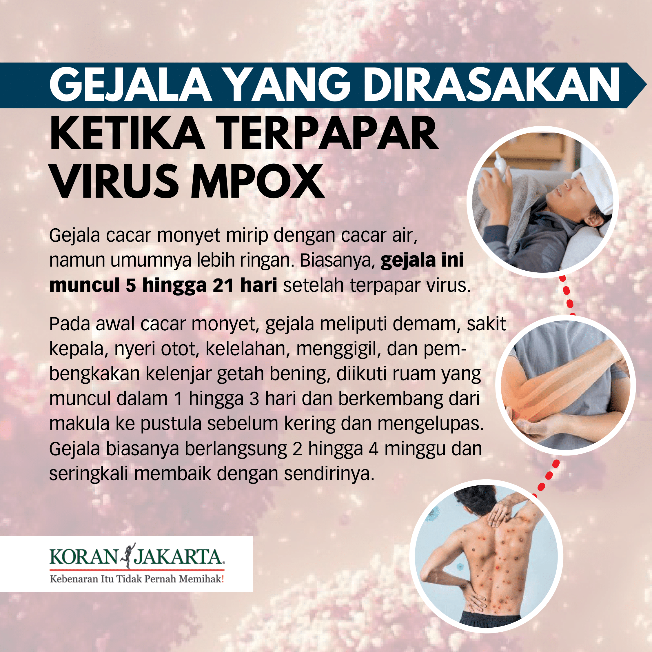 Mengenal Virus Mpox yang Sudah Masuk ke Indonesia, Apakah Berbahaya? 4